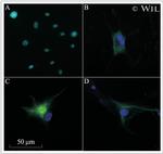 NEFL Antibody in Immunocytochemistry (ICC/IF)