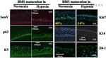 Cytokeratin 5 Antibody in Immunohistochemistry (IHC)