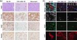 Ki-67 Antibody in Immunohistochemistry (IHC)