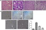 Ki-67 Antibody in Immunohistochemistry (IHC)