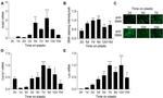 Alpha-Smooth Muscle Actin Antibody in Immunocytochemistry (ICC/IF)