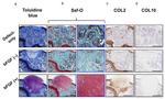 Collagen X Antibody in Immunohistochemistry (IHC)