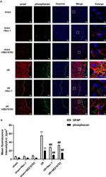 GFAP Antibody in Immunohistochemistry (IHC)