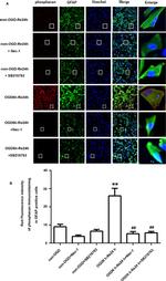 GFAP Antibody in Immunocytochemistry (ICC/IF)