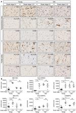 HLA-DR Antibody in Immunohistochemistry (IHC)