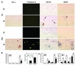 beta Amyloid (1-42) Antibody in Immunohistochemistry, Immunohistochemistry (Paraffin) (IHC, IHC (P))