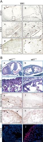 VEGF Receptor 2 Antibody in Immunohistochemistry (IHC)