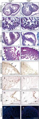 VEGF Receptor 2 Antibody in Immunohistochemistry (IHC)