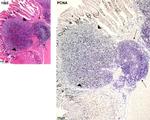 PCNA Antibody in Immunohistochemistry (IHC)