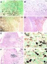 PCNA Antibody in Immunohistochemistry (IHC)