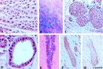 Estrogen Receptor beta Antibody in Immunohistochemistry (IHC)