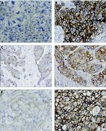 IGF1R alpha Antibody in Immunohistochemistry (IHC)