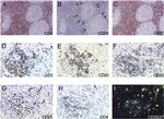 CD4 Antibody in Immunohistochemistry (IHC)