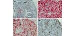 CD44 Antibody in Immunohistochemistry (IHC)