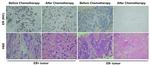 Estrogen Receptor alpha Antibody in Immunohistochemistry (IHC)