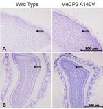 MECP2 Antibody in Immunohistochemistry (IHC)