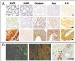 Bax Antibody in Immunohistochemistry (IHC)