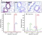 Estrogen Receptor beta Antibody in Immunohistochemistry (IHC)