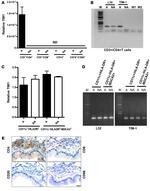 CD8 Antibody in Immunohistochemistry (IHC)