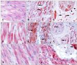 Desmin Antibody in Immunohistochemistry (IHC)