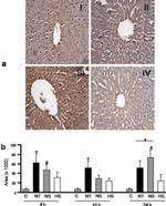 Nitrotyrosine Antibody in Immunohistochemistry (IHC)