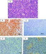 CD3 Antibody in Immunohistochemistry (IHC)