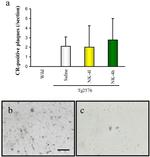 beta Amyloid Antibody in Immunohistochemistry, Immunohistochemistry (Paraffin) (IHC, IHC (P))