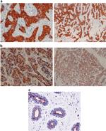 EBP50 Antibody in Immunohistochemistry (IHC)