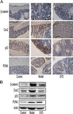 PCNA Antibody in Immunohistochemistry (IHC)