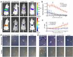 Nitrotyrosine Antibody in Immunohistochemistry (IHC)