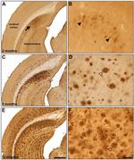 beta Amyloid Antibody in Immunohistochemistry, Immunohistochemistry (Frozen) (IHC, IHC (F))