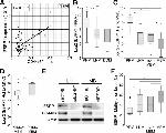 ESRP1 Antibody in Western Blot, Immunohistochemistry (WB, IHC)