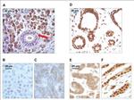 HMGB1 Antibody in Immunohistochemistry, Immunohistochemistry (Paraffin) (IHC, IHC (P))