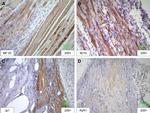 JPH1 Antibody in Immunohistochemistry (IHC)