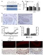 Nitrotyrosine Antibody in Immunohistochemistry (IHC)