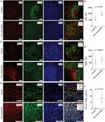 PARP1 (cleaved Asp214, Asp215) Antibody in Immunohistochemistry, Immunohistochemistry (Paraffin) (IHC, IHC (P))