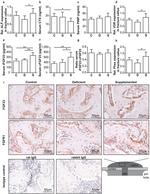 FGFR1 Antibody in Immunohistochemistry (IHC)