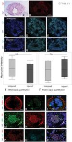 beta-3 Tubulin Antibody in Immunohistochemistry (IHC)