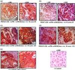 PTPN3 Antibody in Immunohistochemistry (IHC)