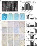 HMOX1 Antibody in Immunohistochemistry (IHC)