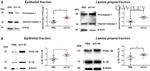 IL-1 beta Antibody in Western Blot (WB)