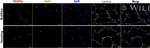 PDGFRA Antibody in Immunocytochemistry (ICC/IF)