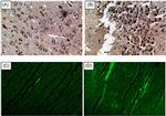 ATG7 Antibody in Immunocytochemistry, Immunohistochemistry (ICC/IF, IHC)