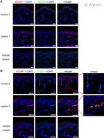 IQGAP1 Antibody in Immunocytochemistry (ICC/IF)