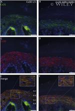 Connexin 26 Antibody in Immunocytochemistry (ICC/IF)