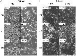 E-cadherin Antibody in Neutralization (Neu)