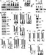 beta Amyloid Antibody in Western Blot, Immunoprecipitation (WB, IP)