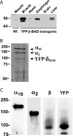 CaV1.1 Antibody in Western Blot (WB)