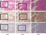 Calcium Sensing Receptor Antibody in Immunohistochemistry (IHC)