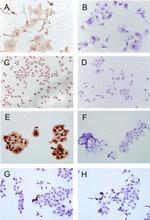 Calcium Sensing Receptor Antibody in Immunocytochemistry (ICC/IF)